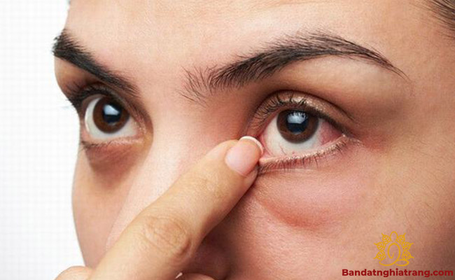 Mắt trái giật liên tục ở nữ giới